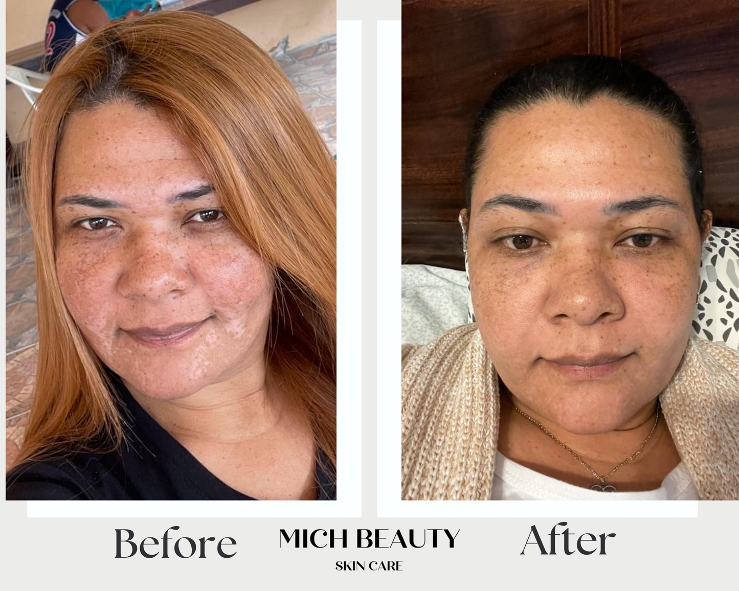 Advanced Brightening Booster